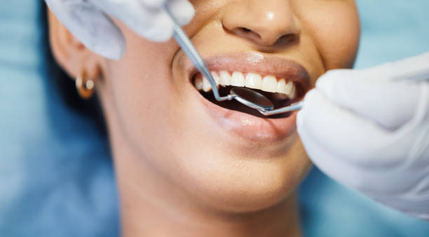 Best Emergency Wisdom Teeth Removal in Duncan Falls, OH