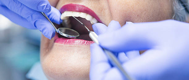 Best Emergency Tooth Extraction in Duncan Falls, OH